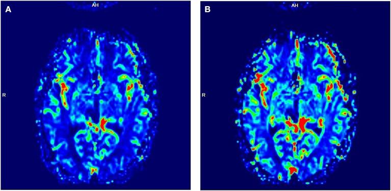 https://cdn.ncbi.nlm.nih.gov/pmc/blobs/fd3a/7186451/5f20fbe2065c/fonc-10-00477-g0003.jpg