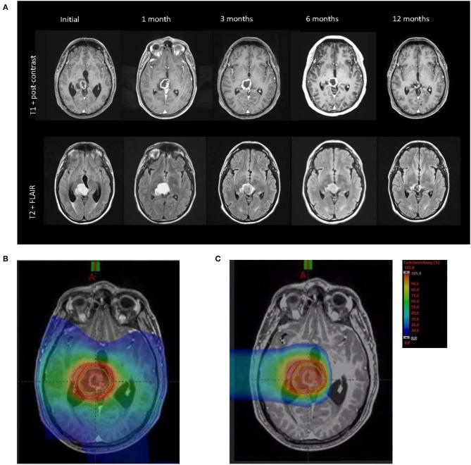 https://cdn.ncbi.nlm.nih.gov/pmc/blobs/fd3a/7186451/b57a5ea8e4a2/fonc-10-00477-g0001.jpg