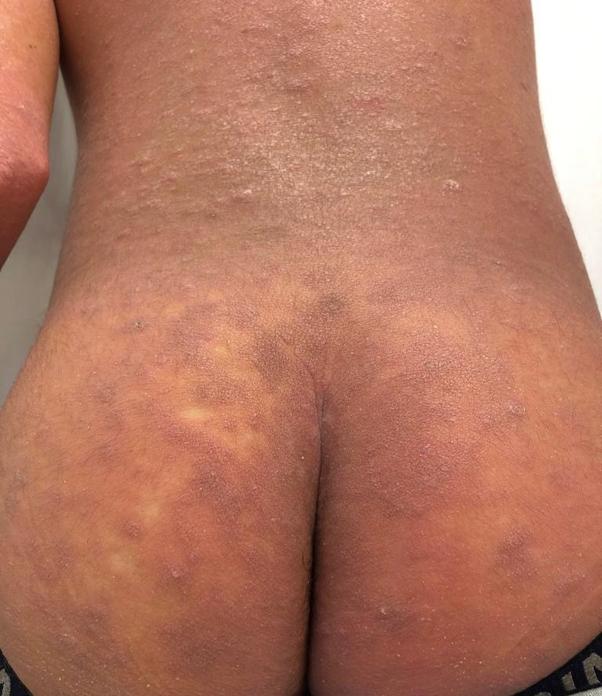 https://cdn.ncbi.nlm.nih.gov/pmc/blobs/fd3f/7200189/21a3c1a12c19/gr1.jpg