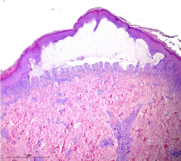 https://cdn.ncbi.nlm.nih.gov/pmc/blobs/fd3f/7200189/943e53125f02/gr4.jpg