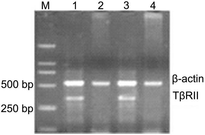 https://cdn.ncbi.nlm.nih.gov/pmc/blobs/fd44/4247285/fb35b5e3748c/ETM-09-01-0227-g00.jpg