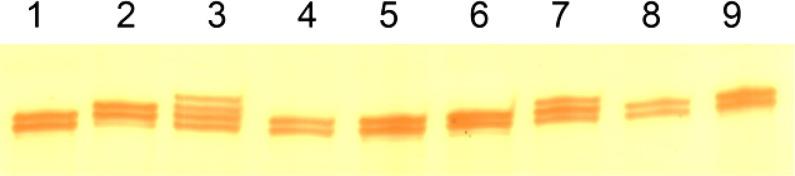 https://cdn.ncbi.nlm.nih.gov/pmc/blobs/fd46/3586882/5ae82379ed04/IJBMS-15-739-g001.jpg