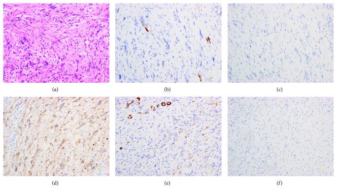 https://cdn.ncbi.nlm.nih.gov/pmc/blobs/fd47/6525918/35b777226b26/GRP2019-3121695.002.jpg