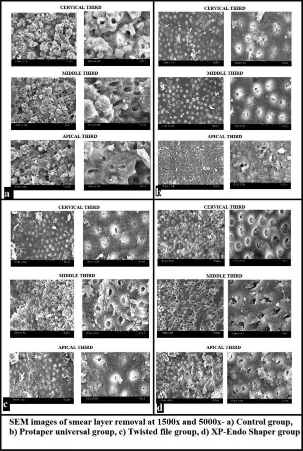 https://cdn.ncbi.nlm.nih.gov/pmc/blobs/fd4f/9089777/741fabe5fc25/JCD-24-568-g007.jpg