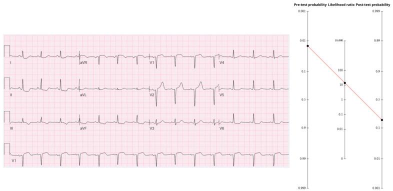 https://cdn.ncbi.nlm.nih.gov/pmc/blobs/fd55/12427917/f8839977382f/diagnostics-15-02148-g004.jpg
