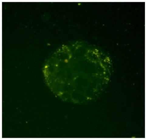 https://cdn.ncbi.nlm.nih.gov/pmc/blobs/fd63/3026577/05ef5c83e142/ijn-6-119f5.jpg