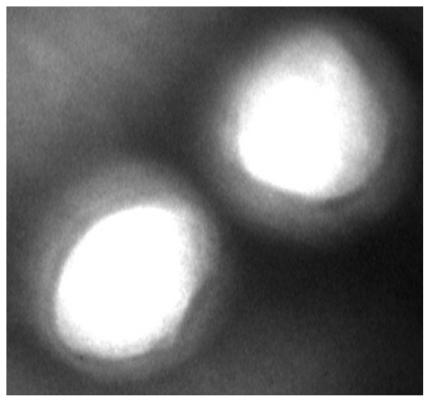 https://cdn.ncbi.nlm.nih.gov/pmc/blobs/fd63/3026577/645adf17a087/ijn-6-119f2.jpg