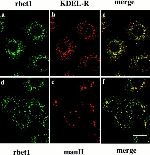 https://cdn.ncbi.nlm.nih.gov/pmc/blobs/fd64/2140212/3ab943c1aa27/JCB.14623f6.jpg