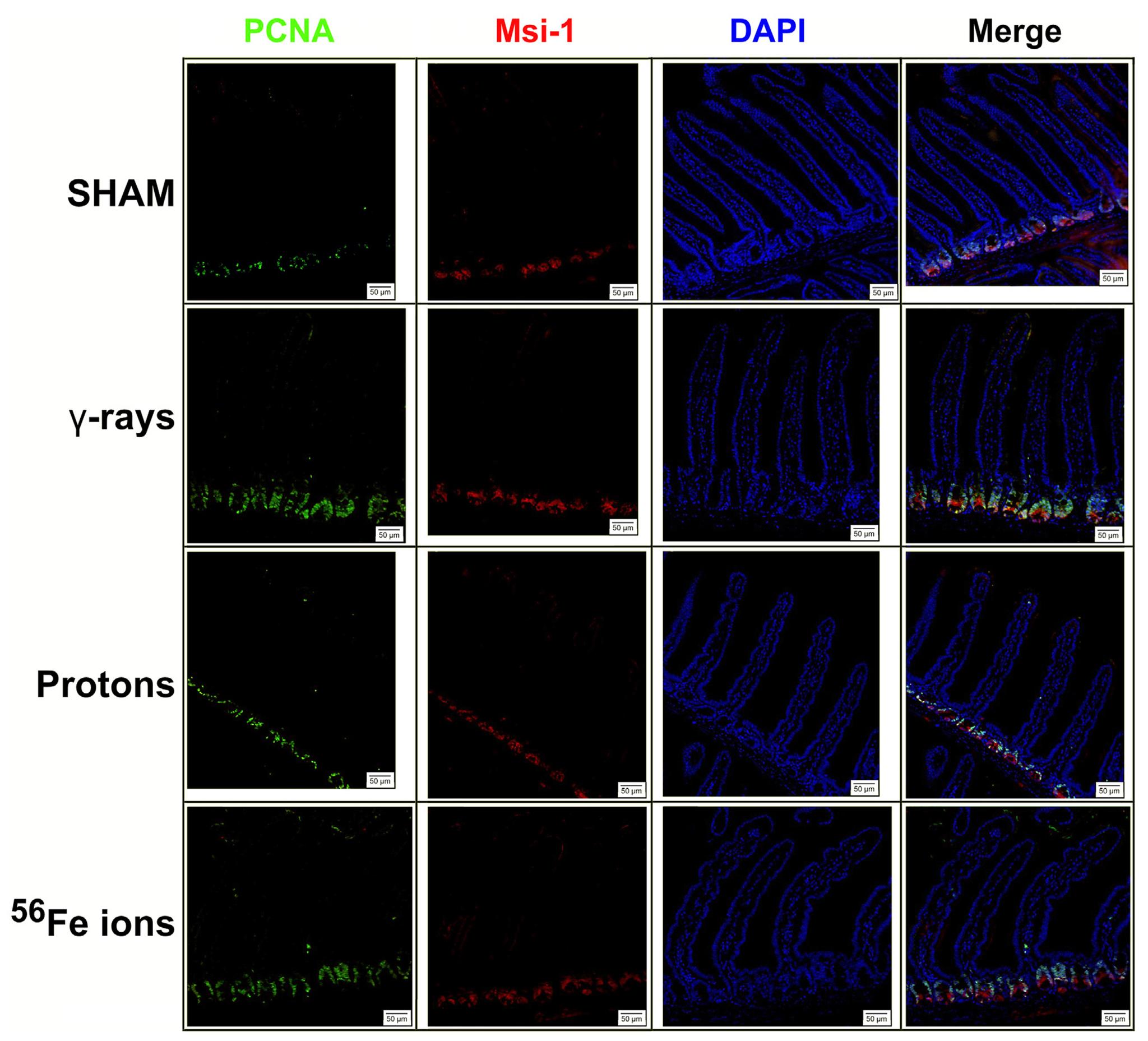 https://cdn.ncbi.nlm.nih.gov/pmc/blobs/fd66/11089821/4e6254852722/nihms-1989029-f0005.jpg