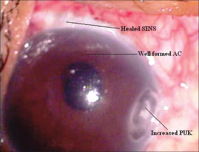 https://cdn.ncbi.nlm.nih.gov/pmc/blobs/fd6d/3519133/ff1cce7f75b0/MEAJO-19-419-g002.jpg