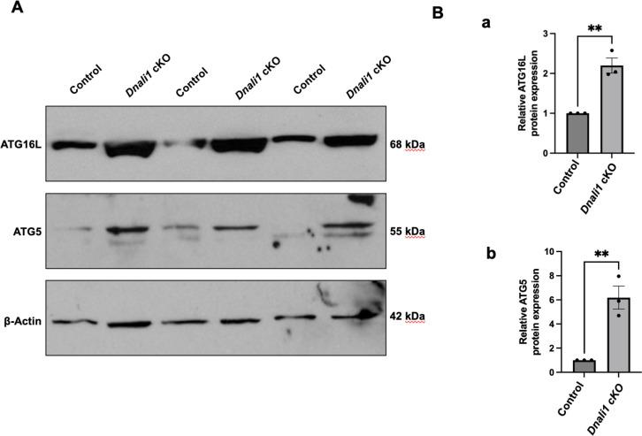 https://cdn.ncbi.nlm.nih.gov/pmc/blobs/fd71/10185345/19d7fb53e789/elife-79620-fig11-figsupp4.jpg