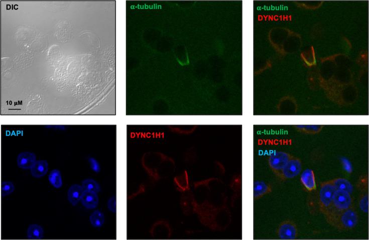 https://cdn.ncbi.nlm.nih.gov/pmc/blobs/fd71/10185345/41e35b924751/elife-79620-fig11-figsupp1.jpg