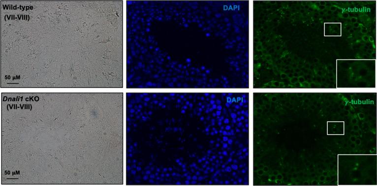https://cdn.ncbi.nlm.nih.gov/pmc/blobs/fd71/10185345/75e166f3e4d2/elife-79620-fig11-figsupp2.jpg