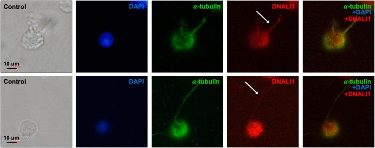 https://cdn.ncbi.nlm.nih.gov/pmc/blobs/fd71/10185345/a02dbf61d170/elife-79620-fig11-figsupp3.jpg