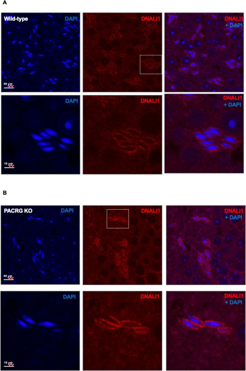 https://cdn.ncbi.nlm.nih.gov/pmc/blobs/fd71/10185345/a778fb6a34c1/elife-79620-fig4-figsupp1.jpg