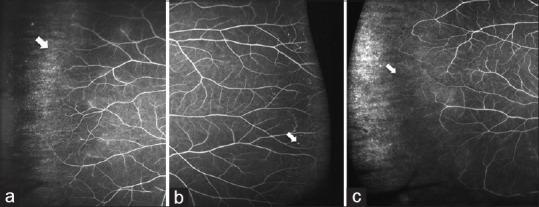 https://cdn.ncbi.nlm.nih.gov/pmc/blobs/fd77/8012972/92d5c65315c7/IJO-69-824-g001.jpg