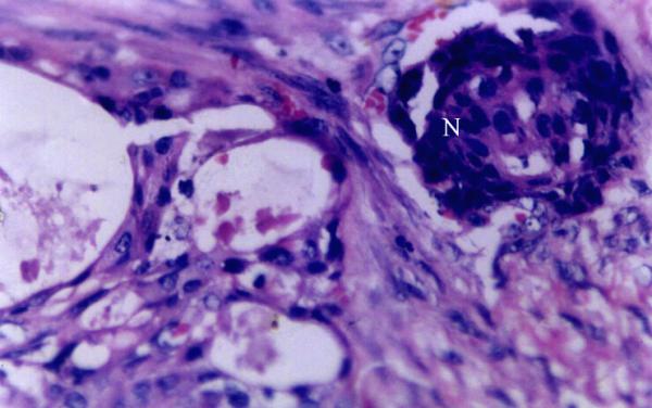 https://cdn.ncbi.nlm.nih.gov/pmc/blobs/fd78/156026/ade4528200d2/1477-7819-1-1-4.jpg