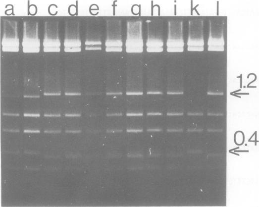 https://cdn.ncbi.nlm.nih.gov/pmc/blobs/fd7d/557729/09d14106da81/emboj00315-0112-a.jpg