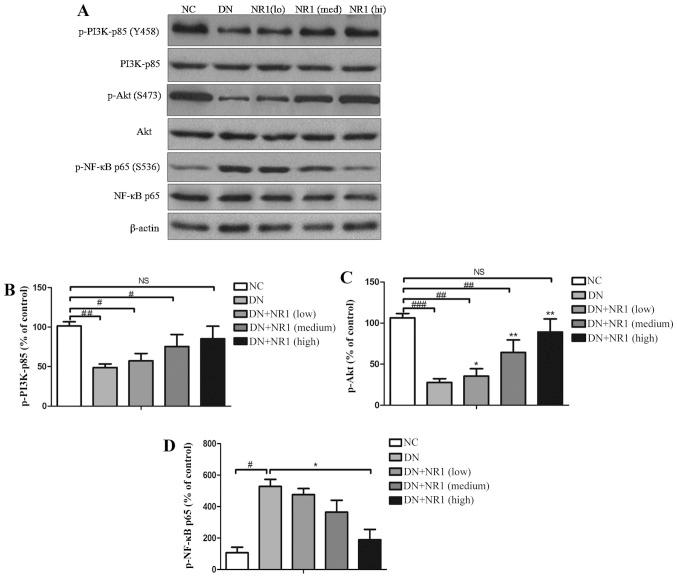 https://cdn.ncbi.nlm.nih.gov/pmc/blobs/fd7e/5029967/32708ffbc4a8/IJMM-38-04-1179-g05.jpg