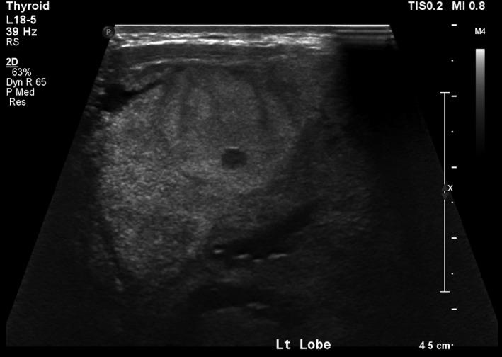 https://cdn.ncbi.nlm.nih.gov/pmc/blobs/fd7e/5676271/10f891a33580/CCR3-5-1789-g001.jpg