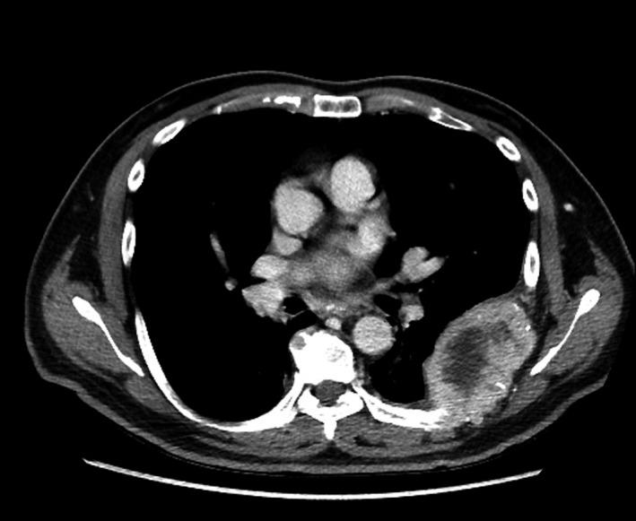 https://cdn.ncbi.nlm.nih.gov/pmc/blobs/fd7e/5676271/4deda5770145/CCR3-5-1789-g002.jpg