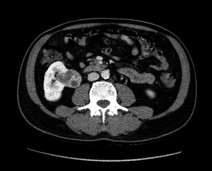 https://cdn.ncbi.nlm.nih.gov/pmc/blobs/fd7e/5676271/defe0ccb6e32/CCR3-5-1789-g003.jpg