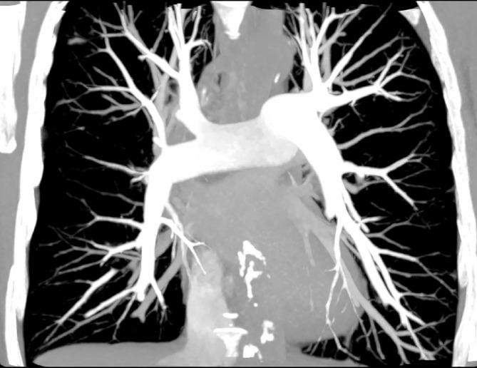 https://cdn.ncbi.nlm.nih.gov/pmc/blobs/fd8e/7336071/df7fd10c3e30/bjr.20190995.g004.jpg