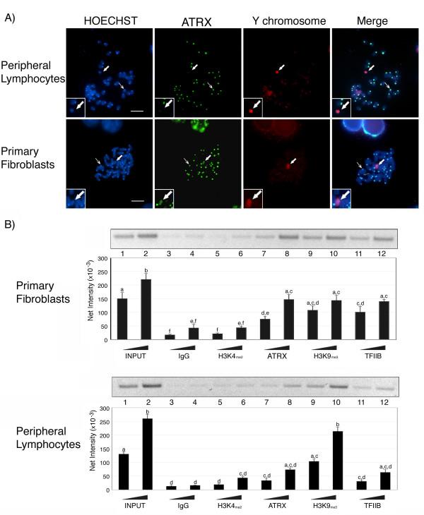 https://cdn.ncbi.nlm.nih.gov/pmc/blobs/fd96/2275742/86694ad0ea3f/1471-2199-9-29-4.jpg