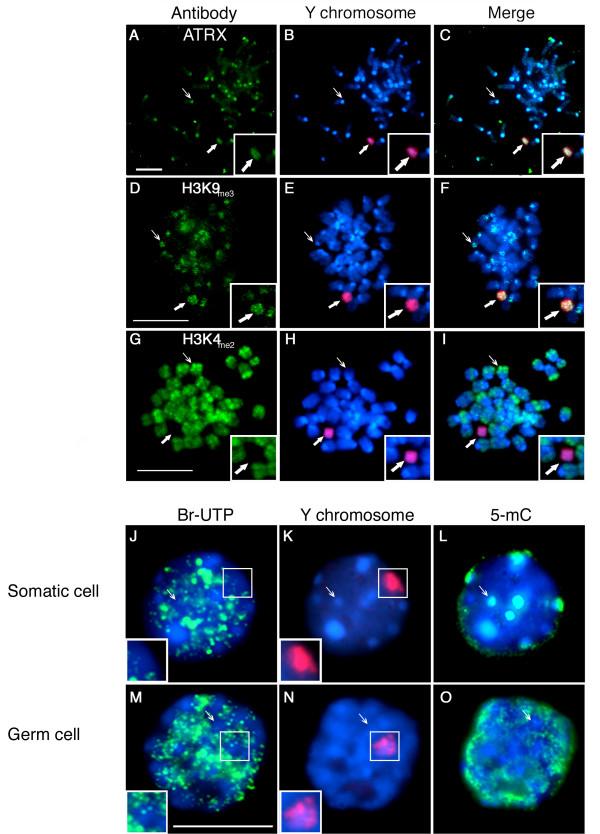 https://cdn.ncbi.nlm.nih.gov/pmc/blobs/fd96/2275742/dc60377e8bd2/1471-2199-9-29-3.jpg