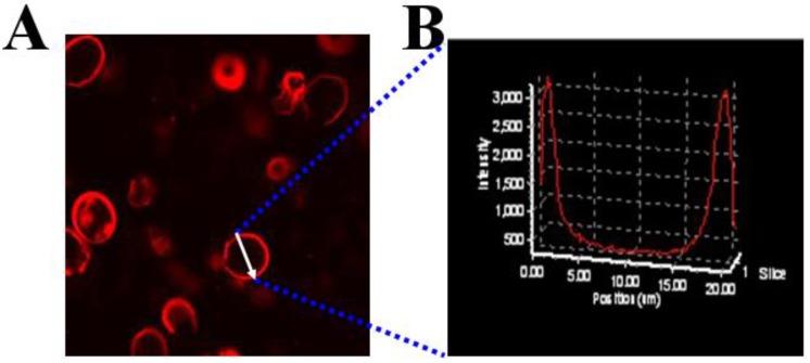 https://cdn.ncbi.nlm.nih.gov/pmc/blobs/fd9c/4329499/592a5a26018b/thnov05p0345g003.jpg