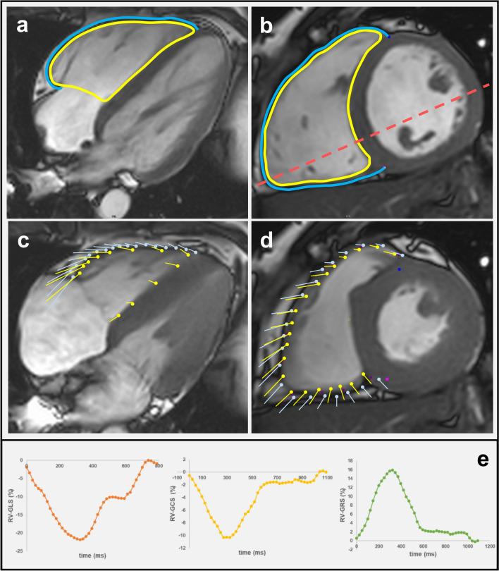 https://cdn.ncbi.nlm.nih.gov/pmc/blobs/fd9d/11885332/0a26d86cbece/12265_2024_10557_Fig2_HTML.jpg
