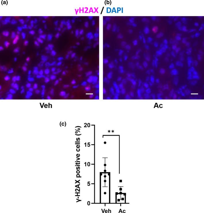 https://cdn.ncbi.nlm.nih.gov/pmc/blobs/fd9e/10354006/3cd16b51c231/PHY2-11-e15774-g003.jpg