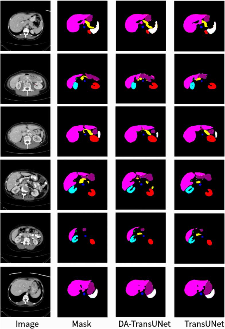 https://cdn.ncbi.nlm.nih.gov/pmc/blobs/fd9f/11141164/1fbc10bc1828/fbioe-12-1398237-g005.jpg