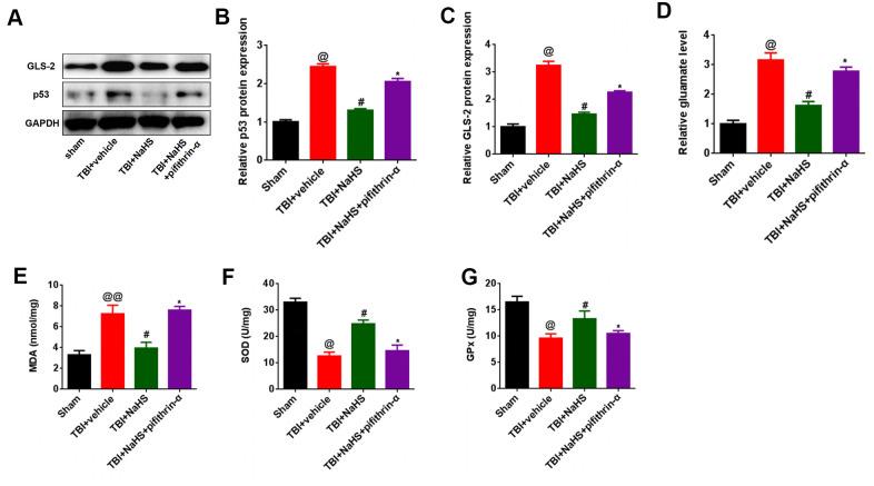 https://cdn.ncbi.nlm.nih.gov/pmc/blobs/fda5/7993660/7e8cc17b82ce/aging-13-202575-g005.jpg