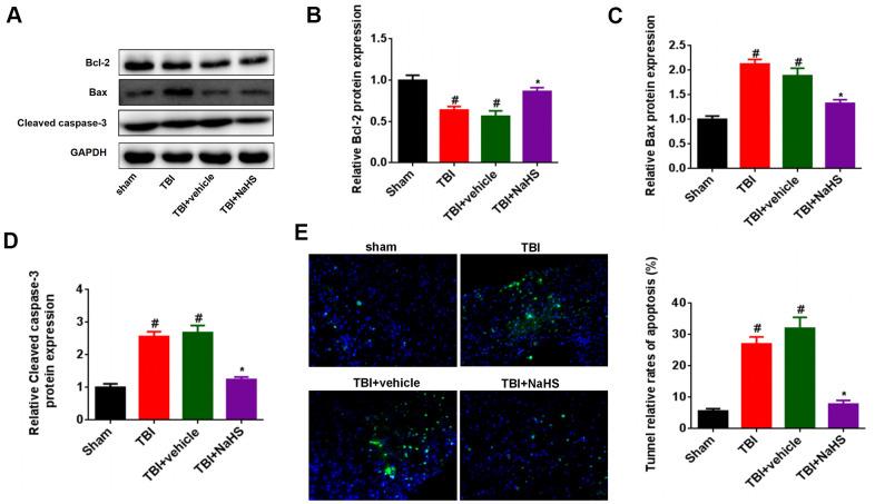 https://cdn.ncbi.nlm.nih.gov/pmc/blobs/fda5/7993660/94b685308cd4/aging-13-202575-g002.jpg
