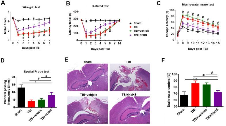 https://cdn.ncbi.nlm.nih.gov/pmc/blobs/fda5/7993660/dd8566d612c8/aging-13-202575-g001.jpg