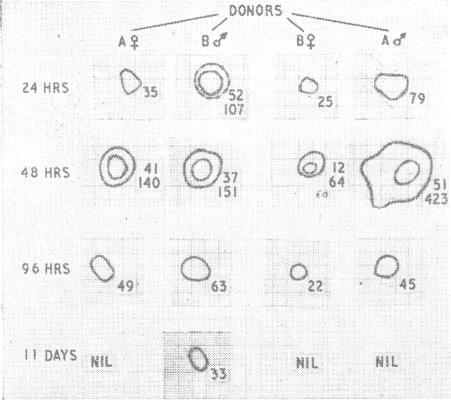 https://cdn.ncbi.nlm.nih.gov/pmc/blobs/fda6/1817017/dc91f897b8cc/brmedj02574-0044-a.jpg