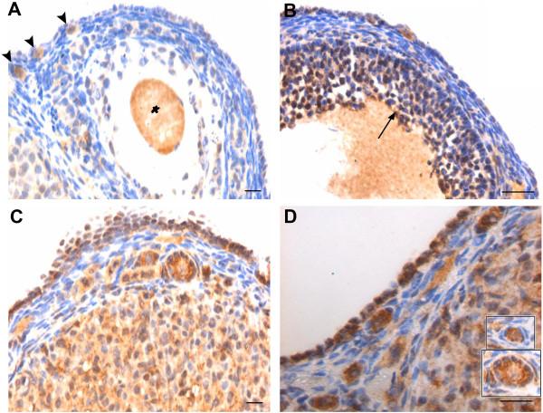 https://cdn.ncbi.nlm.nih.gov/pmc/blobs/fdb5/3616927/75ebeb909cf3/1757-2215-5-32-7.jpg