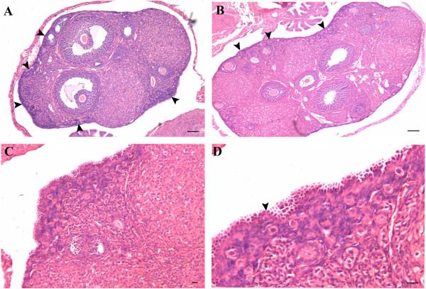 https://cdn.ncbi.nlm.nih.gov/pmc/blobs/fdb5/3616927/a4d689de87b8/1757-2215-5-32-5.jpg