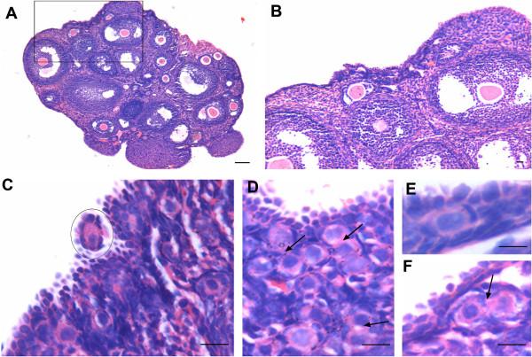https://cdn.ncbi.nlm.nih.gov/pmc/blobs/fdb5/3616927/ba97870425c4/1757-2215-5-32-2.jpg