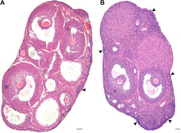 https://cdn.ncbi.nlm.nih.gov/pmc/blobs/fdb5/3616927/dbad6bc9385e/1757-2215-5-32-4.jpg