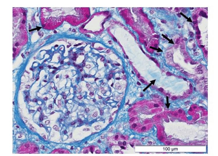 https://cdn.ncbi.nlm.nih.gov/pmc/blobs/fdb8/12107502/864241378183/cureus-0017-00000083061-i01.jpg