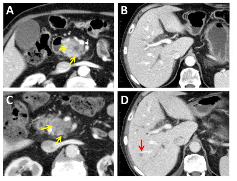 https://cdn.ncbi.nlm.nih.gov/pmc/blobs/fdc1/8000738/73e83c502260/jcm-10-01151-g002.jpg