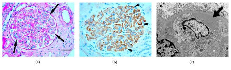 https://cdn.ncbi.nlm.nih.gov/pmc/blobs/fdc4/5514321/e9cdfe1df37c/CRIOG2017-8698670.001.jpg