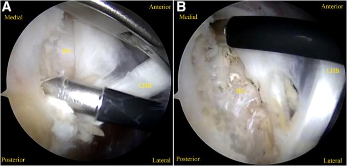 https://cdn.ncbi.nlm.nih.gov/pmc/blobs/fdc8/11873464/380a91fe5e05/gr3.jpg