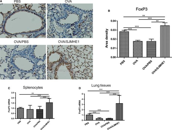 https://cdn.ncbi.nlm.nih.gov/pmc/blobs/fdca/6815837/7b56d541f823/JCMM-23-7819-g005.jpg