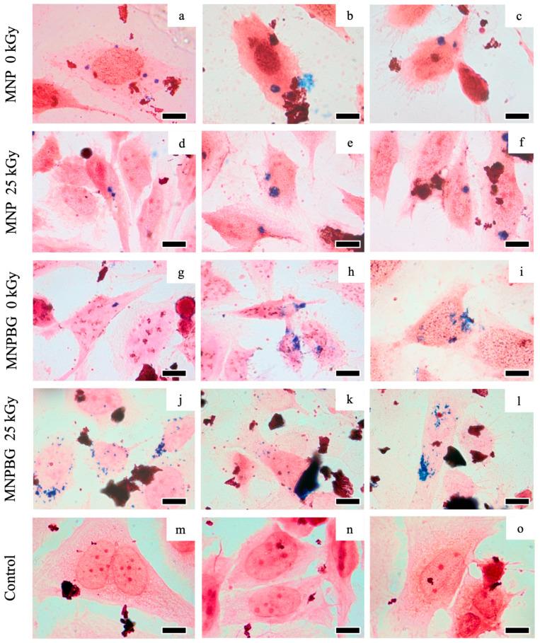 https://cdn.ncbi.nlm.nih.gov/pmc/blobs/fdd0/12389458/289bcb3ed0cc/pharmaceutics-17-01048-g010.jpg