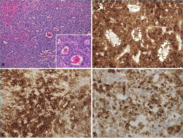 https://cdn.ncbi.nlm.nih.gov/pmc/blobs/fdd1/9040550/4ba558d43ebd/pathol-2022-01-64-g005.jpg