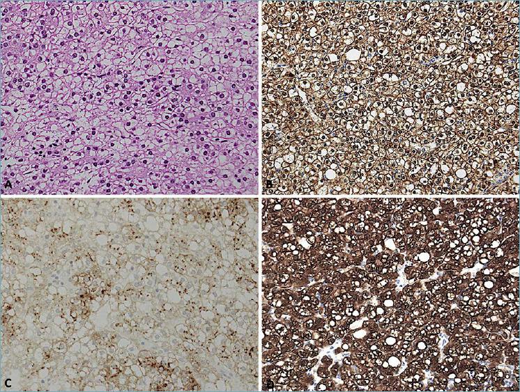 https://cdn.ncbi.nlm.nih.gov/pmc/blobs/fdd1/9040550/acea58a1afab/pathol-2022-01-64-g003.jpg