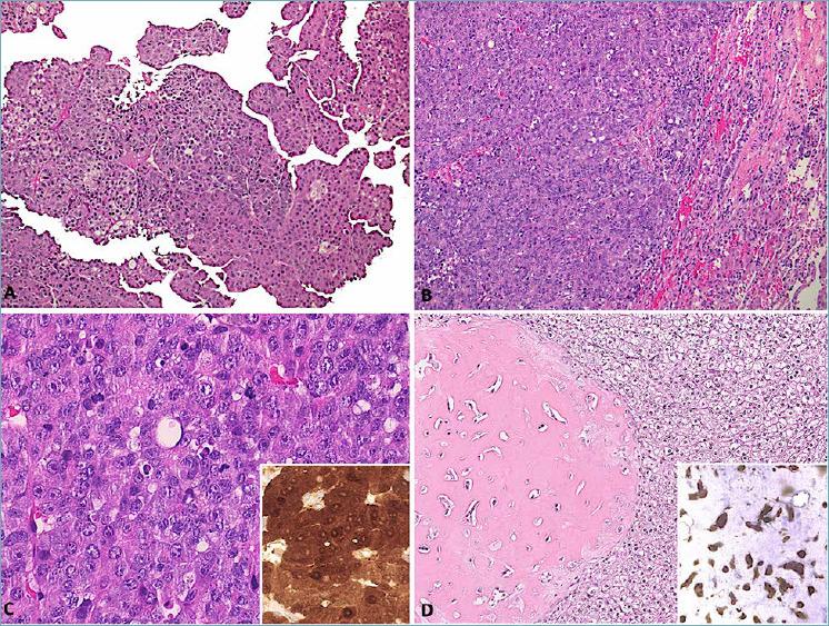 https://cdn.ncbi.nlm.nih.gov/pmc/blobs/fdd1/9040550/d91ea76701c9/pathol-2022-01-64-g006.jpg